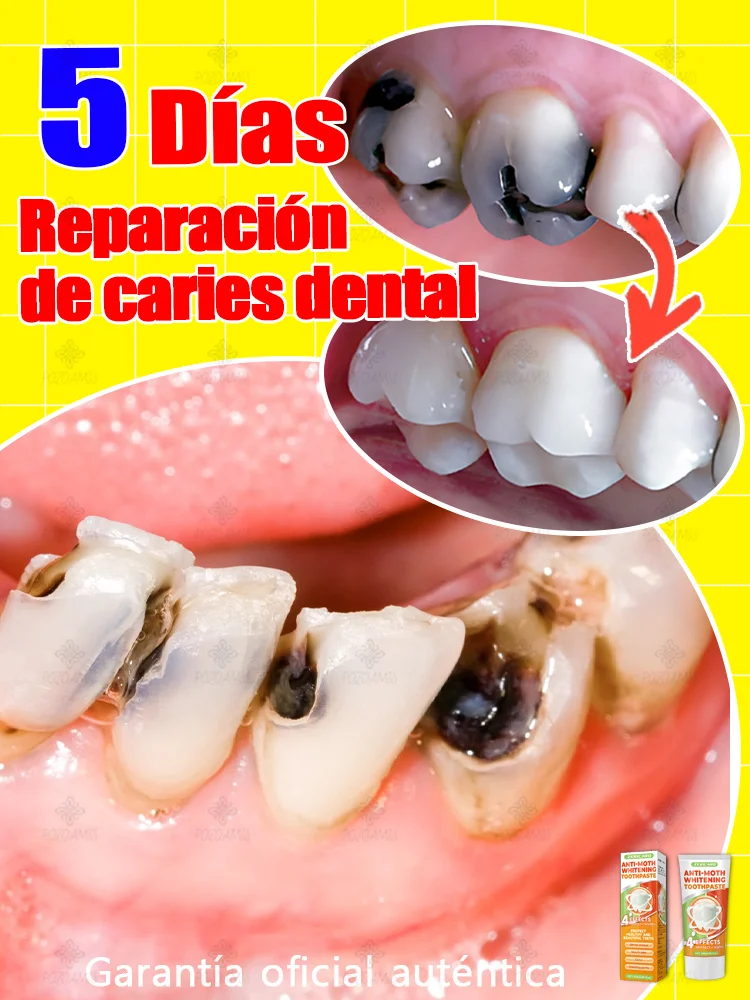 Reparar caries, caries dental, aliviar dolor de encías, blanqueamiento dental