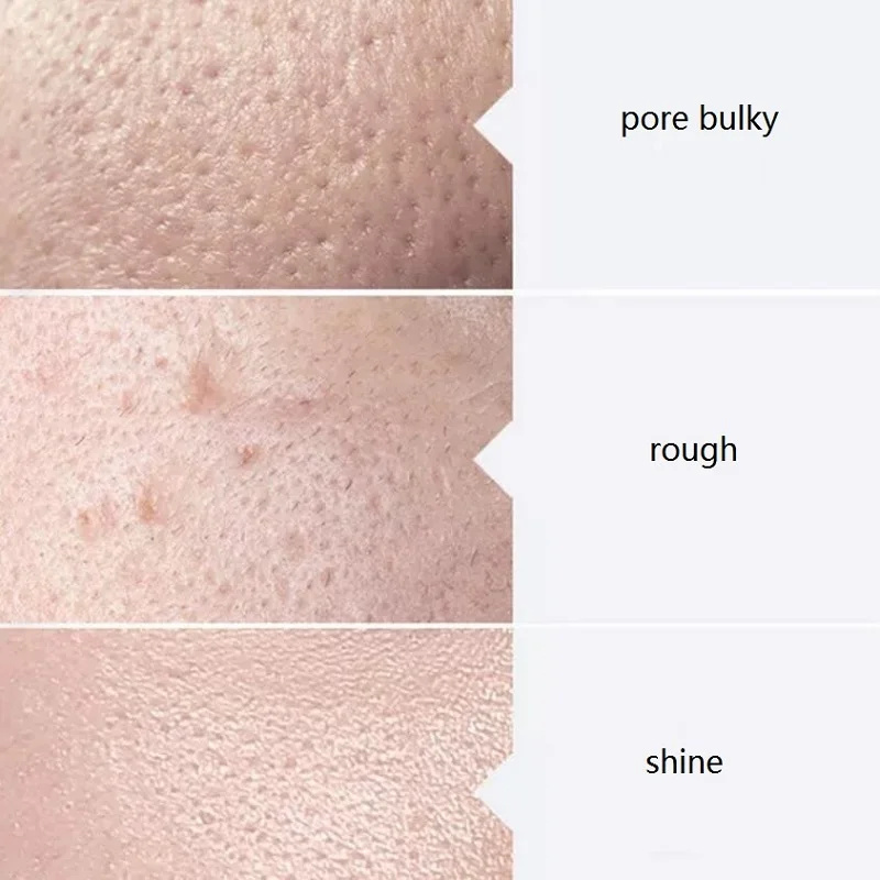 Suero facial para el cuidado de la piel AS1 SA2 AO3 Aqua Peel Solución para máquina facial Limpieza profunda de la piel 400 ml Kit de 3 sueros
