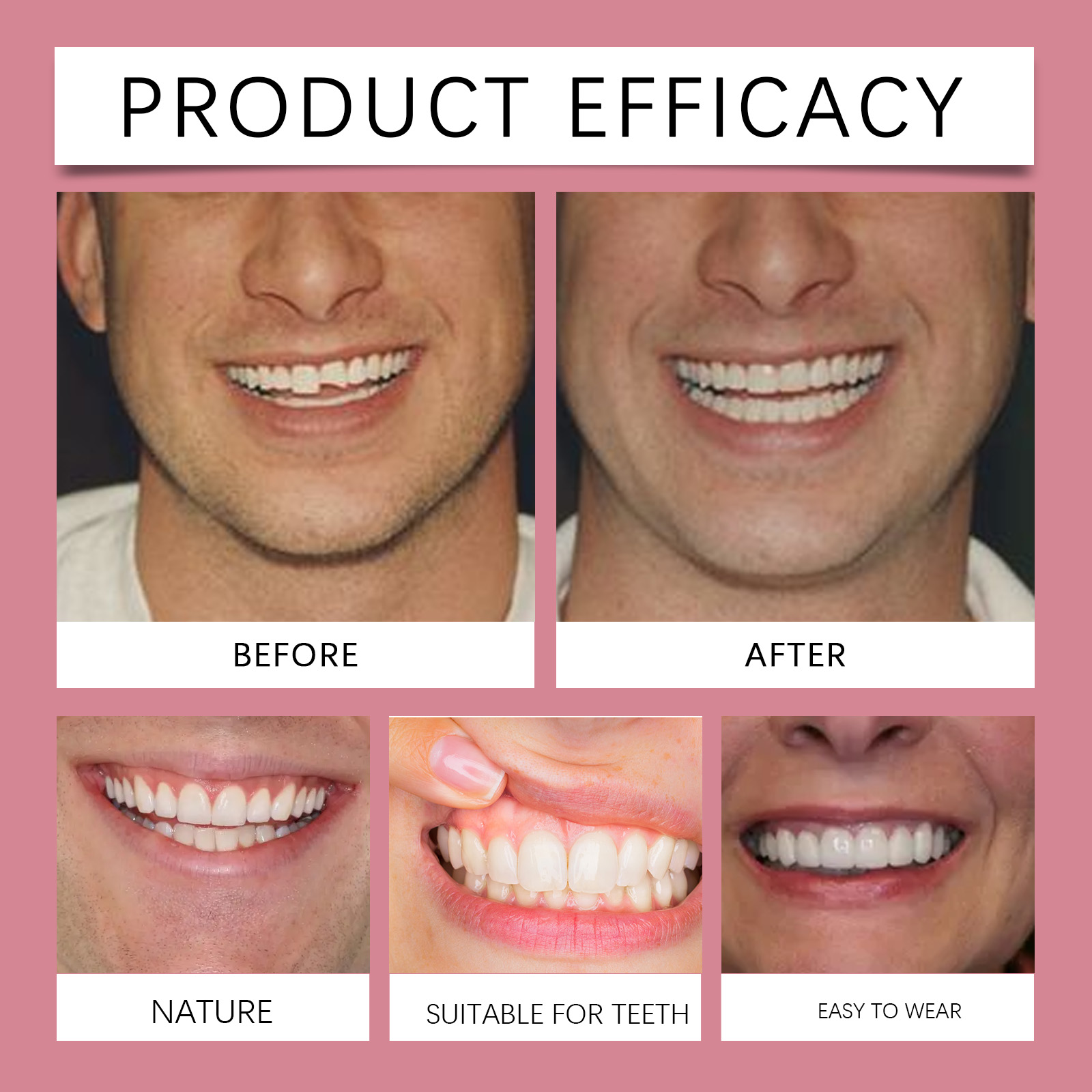 New False Teeth Silicone Upper & Lower Veneers Perfect Laugh Veneers Dentures Paste Fake Teeth Braces Comfortable Teeth