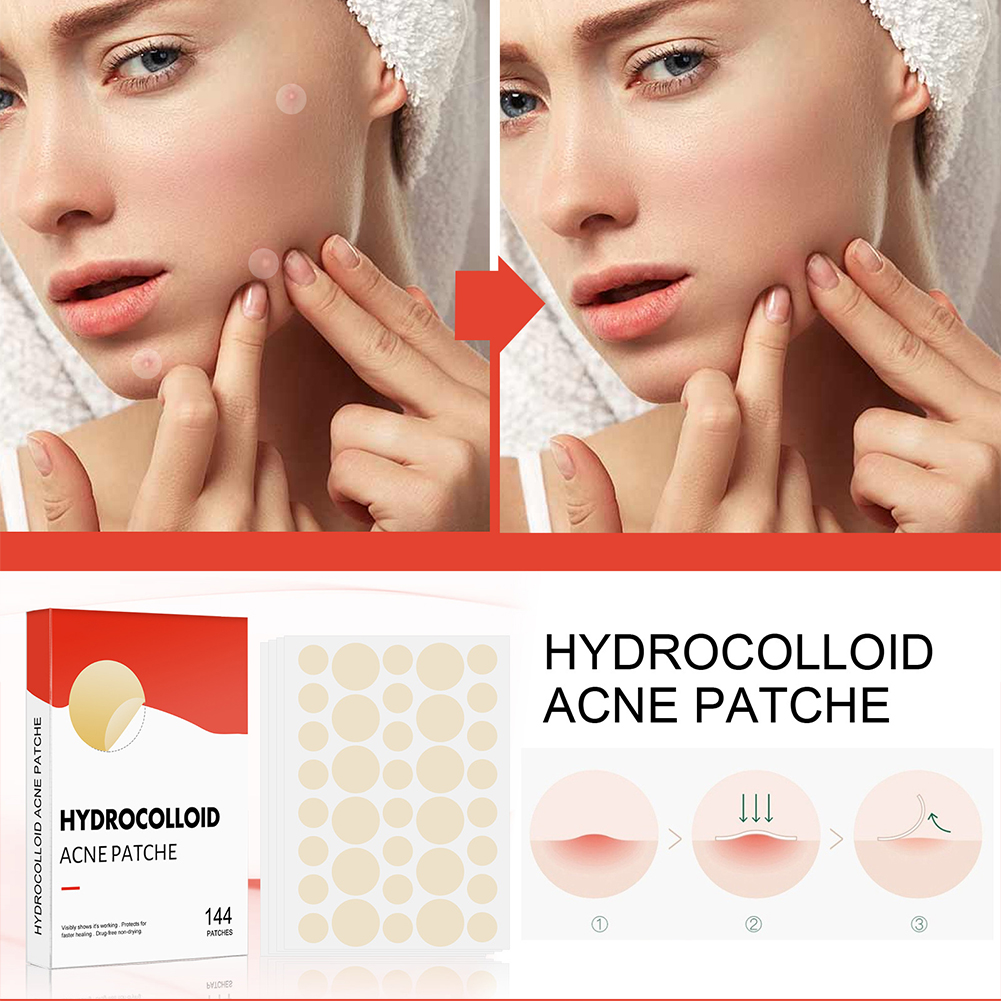 144 pz/set Viso Cura Della Pelle Acne Brufolo Patch 2 Formati Invisibile Guarigione Professionale Assorbente Spot Adesivo di Copertura per Le Donne Degli Uomini