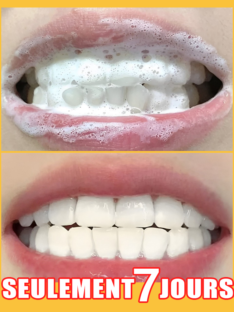 Blanchiment des dents, restauration rapide et naturelle des gencives, avis utilisateurs extrêmement positifs
