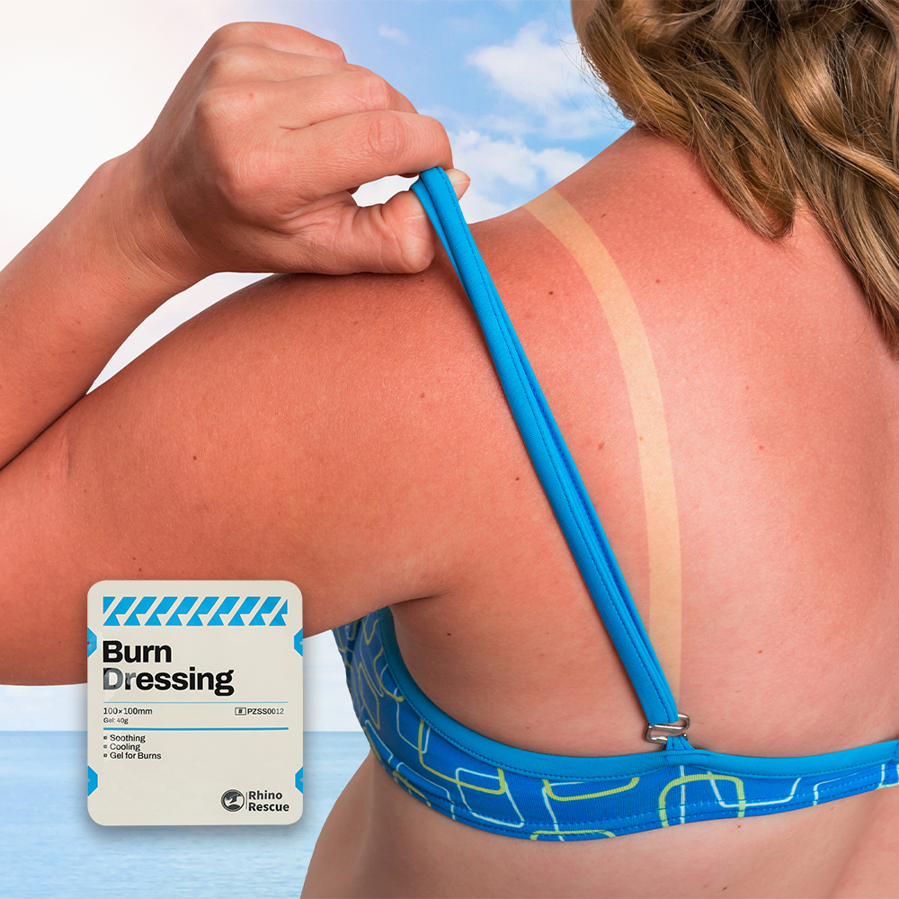 Gel de cuidados com queimaduras de emergência, creme calmante para alívio de queimaduras solares, conforto instantâneo para queimaduras