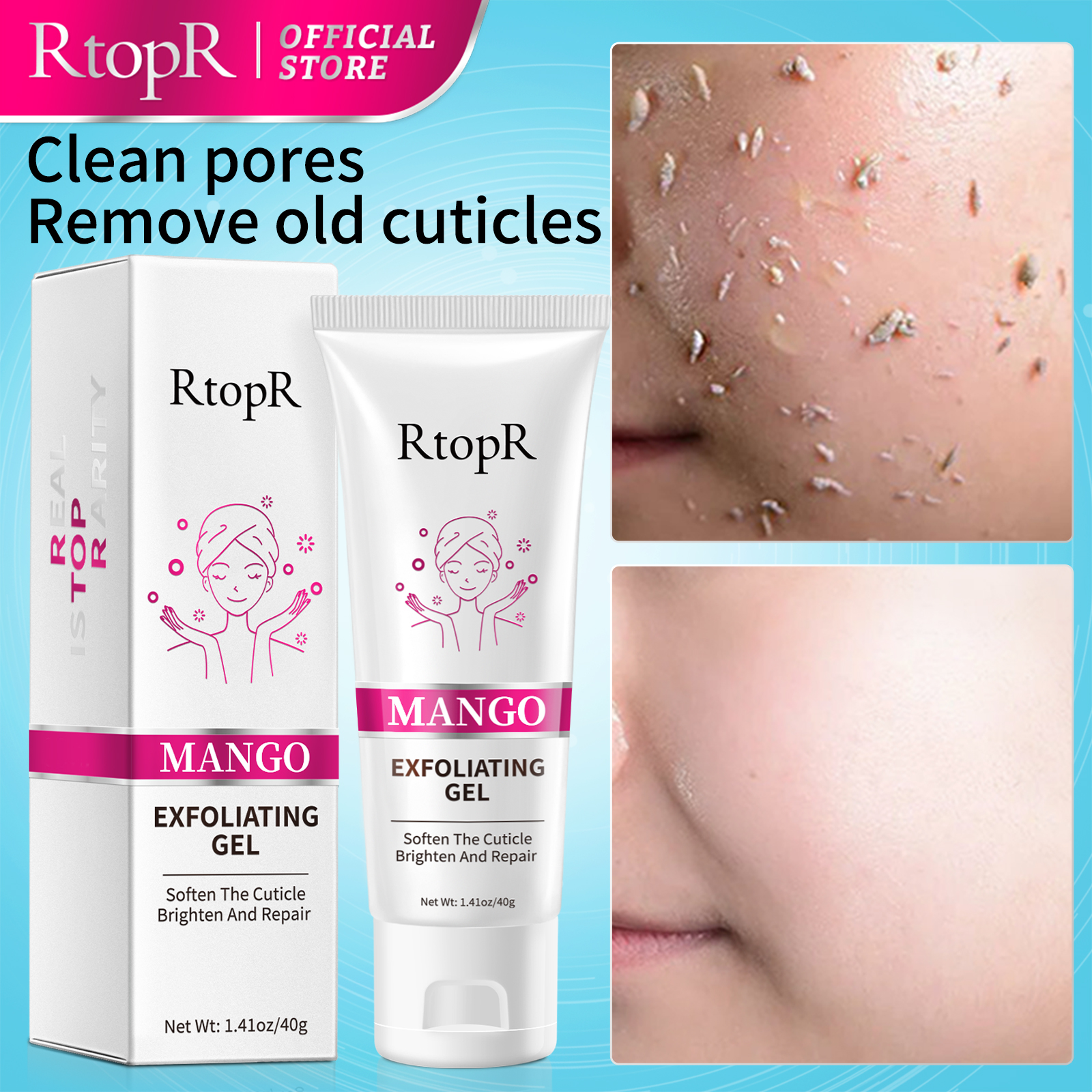 Gel exfoliante Facial para el cuidado de la piel, blanqueador, reparación hidratante, exfoliante Facial, limpiador, crema para espinillas y acné, cuidado Facial