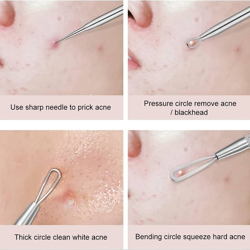 4 Teile/satz Akne Mitesser Nadel Set Unscented Blemish PoreCleanser Nadel Haken Spot Pickel Entferner Hautpflege Werkzeuge Zubehör