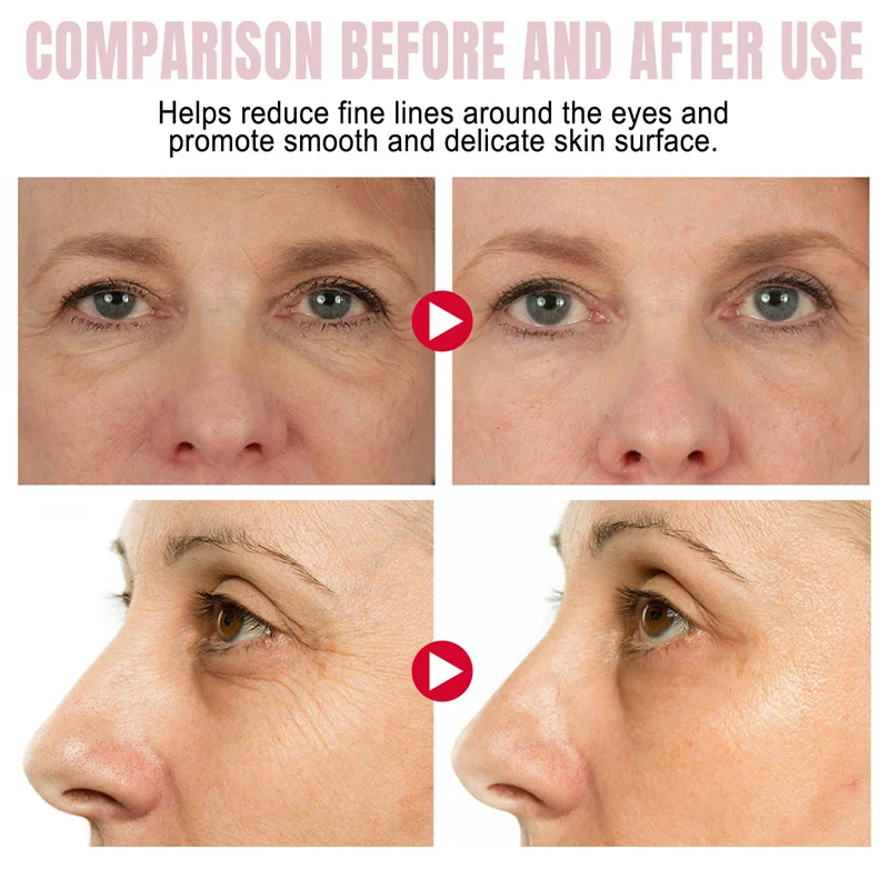 Crema de eliminación instantánea de bolsas de ojos, colágeno, antiarrugas, decoloración de líneas finas, reafirmante de la piel, anticírculo oscuro, hinchazón, ilumina el cuidado de los ojos