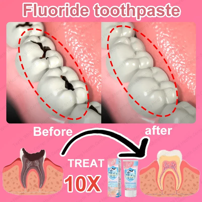 99% , s, 