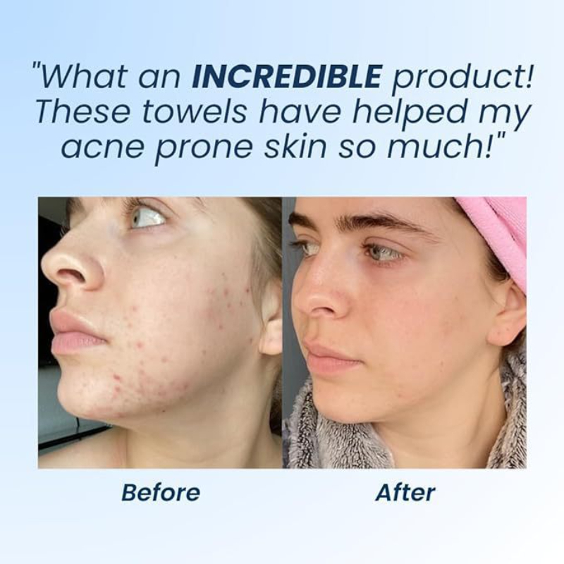 Novas toalhas limpas do clube de pele limpa Xl ™ , Toalha facial descartável, toalhetes secos removedor de maquiagem 50 folhas, 1 caixa