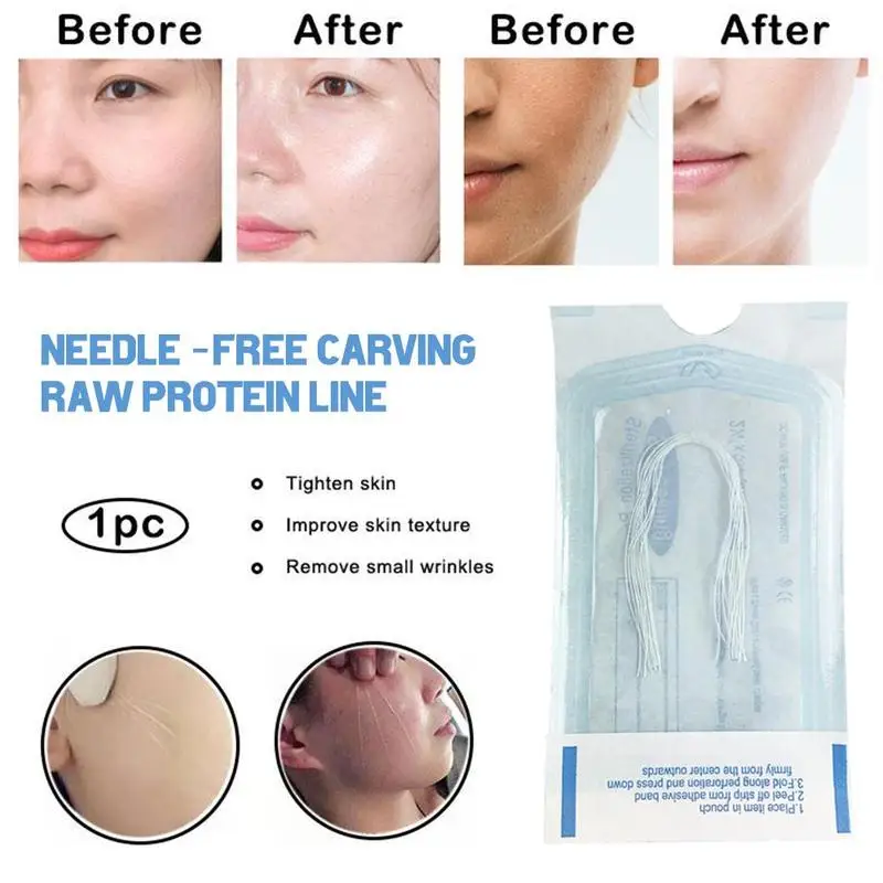 60/120 pces absorvível sem agulha linha de proteína de ouro anti-rugas rosto enchimento elevador endurecimento linha de colágeno anti-envelhecimento cuidados com a pele