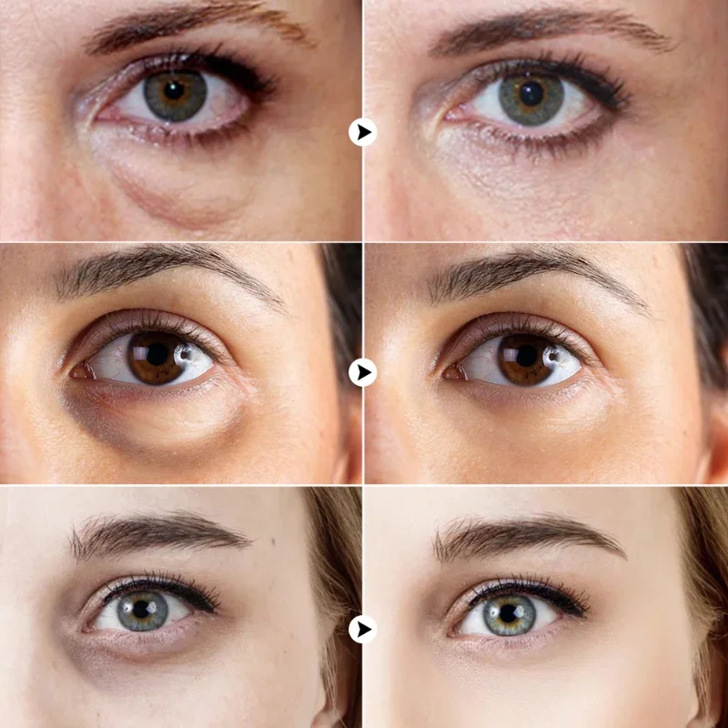 Patchs pour les yeux au collagène d'algues sous les yeux Patch en Gel pour œdème Patch pour les yeux Hydrogel des cernes patchs masque pour les yeux soin 80g