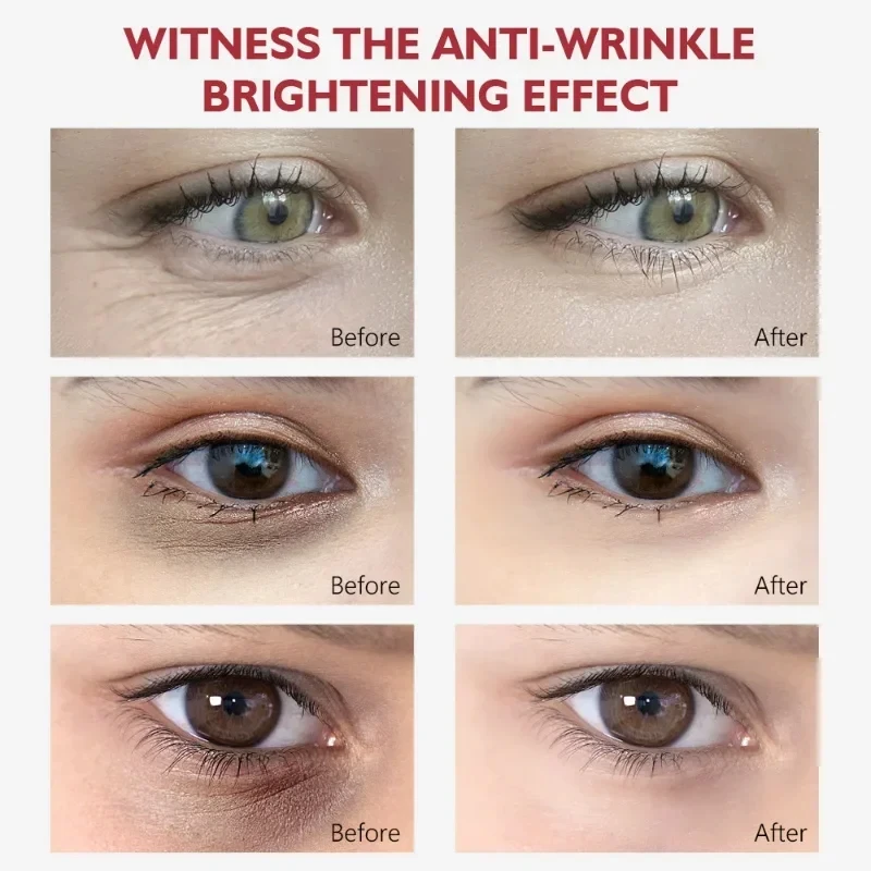 Creme para os olhos com nicotinamida, creme para olheiras, remove bolsas para os olhos, ácido hialurônico, soro hidratante contra inchaço, gel para cuidados com os olhos