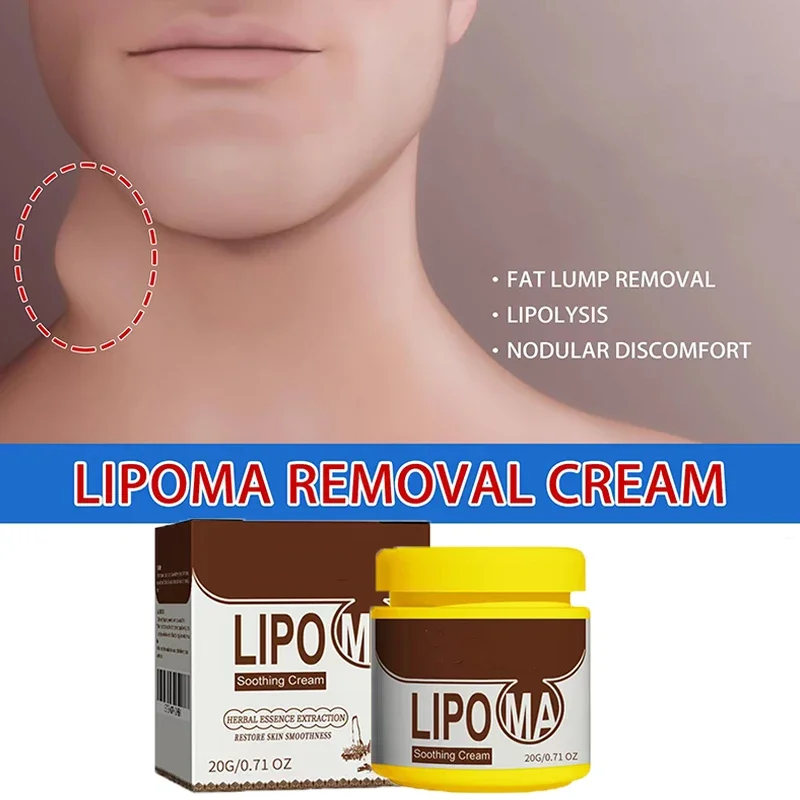 Crema calmante removedor de grumos subcutáneos