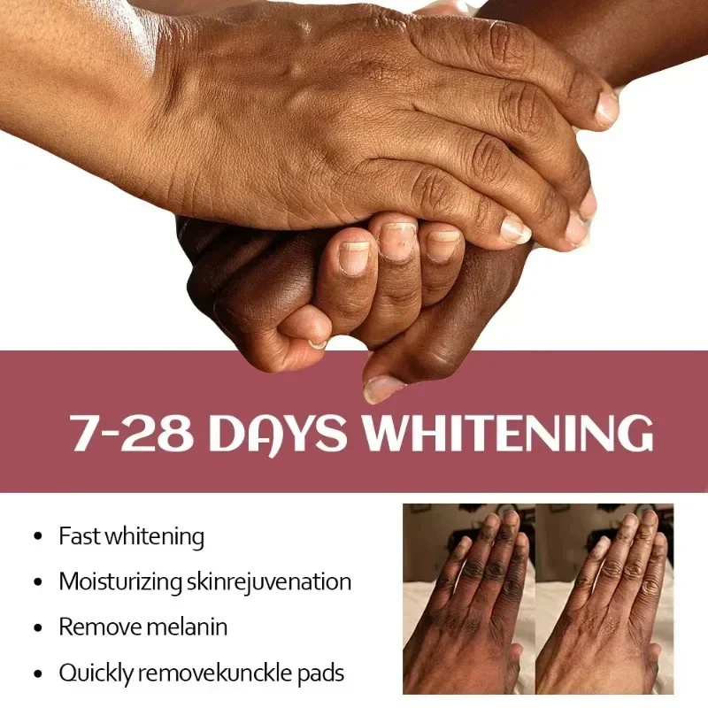 Fast Whitening Dark Knuckles Cream Brighten Hand Cream Lighten Melanin Stains Corrector Hand Anti Crack Soften Moisturize Produc