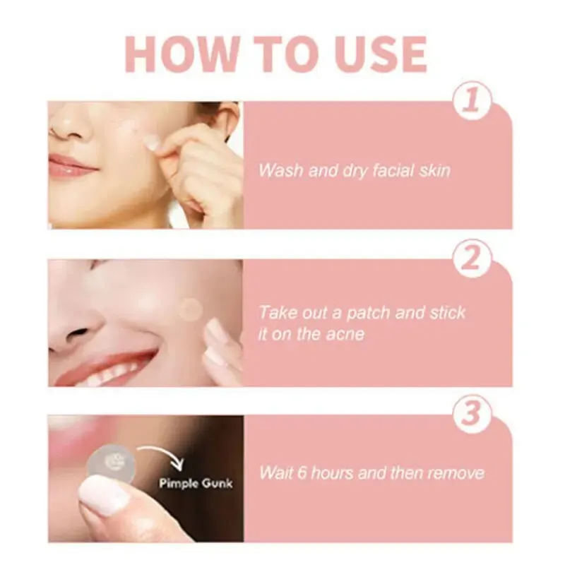【Hot sales】72pcs Patches The Look Of Comedo And Invisible Concealer Breathable Covering Patch，Facial oil blotting paper