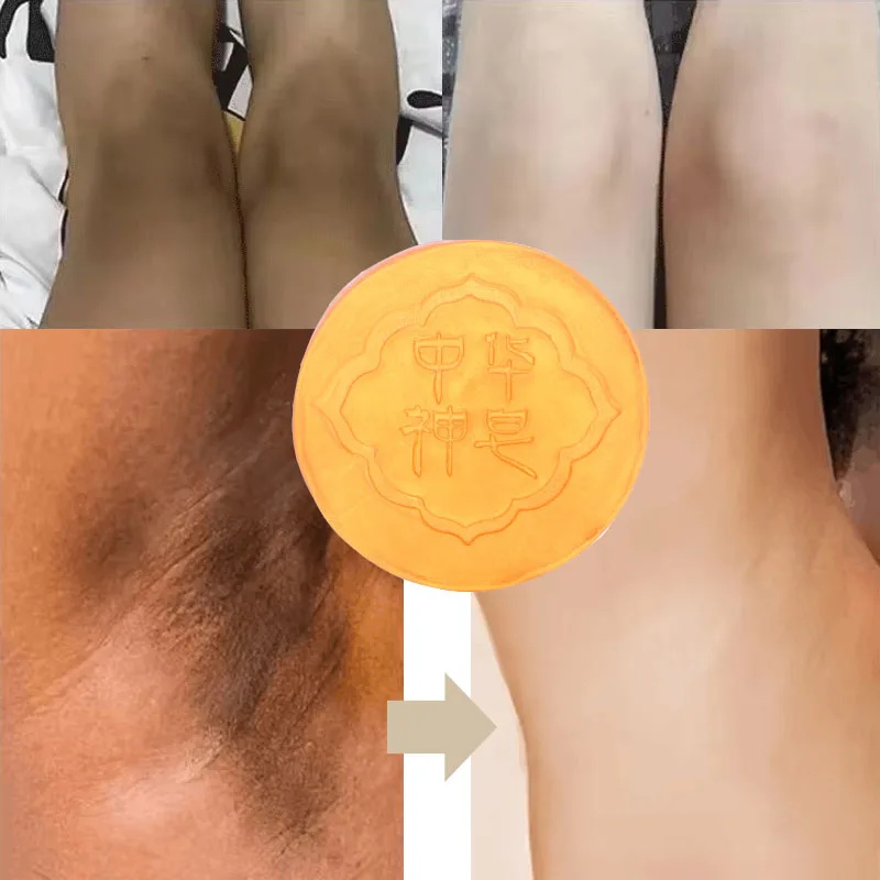 Sabonete clareador corporal, limpeza profunda, axilas, pernas, joelhos, axilas, branqueamento de pele de frango, sabonete para iluminar, cuidados com a pele suave e justo