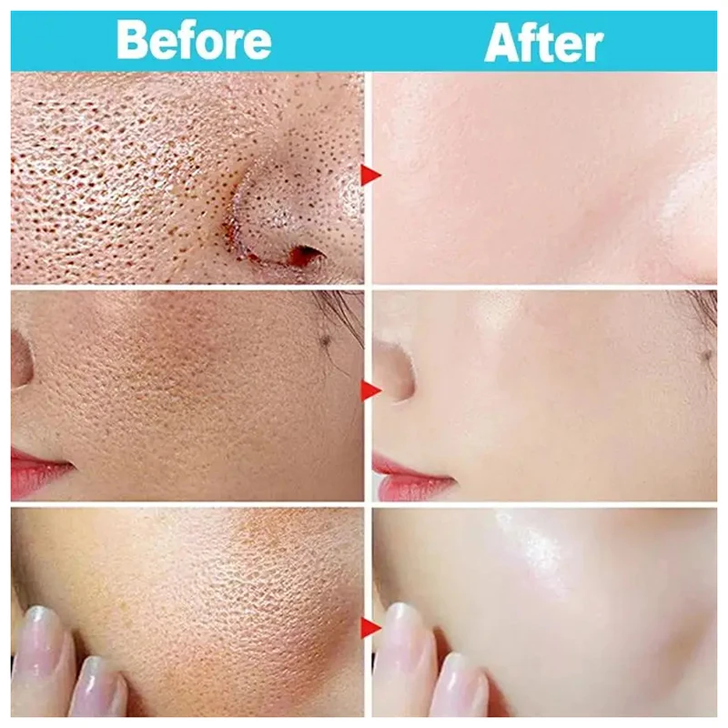 Hot Salicylic Acid Pore Shrinking Cream Quick Elimination Large Pores Remove Blackehead Tighten Face Smooth Skin Care Products