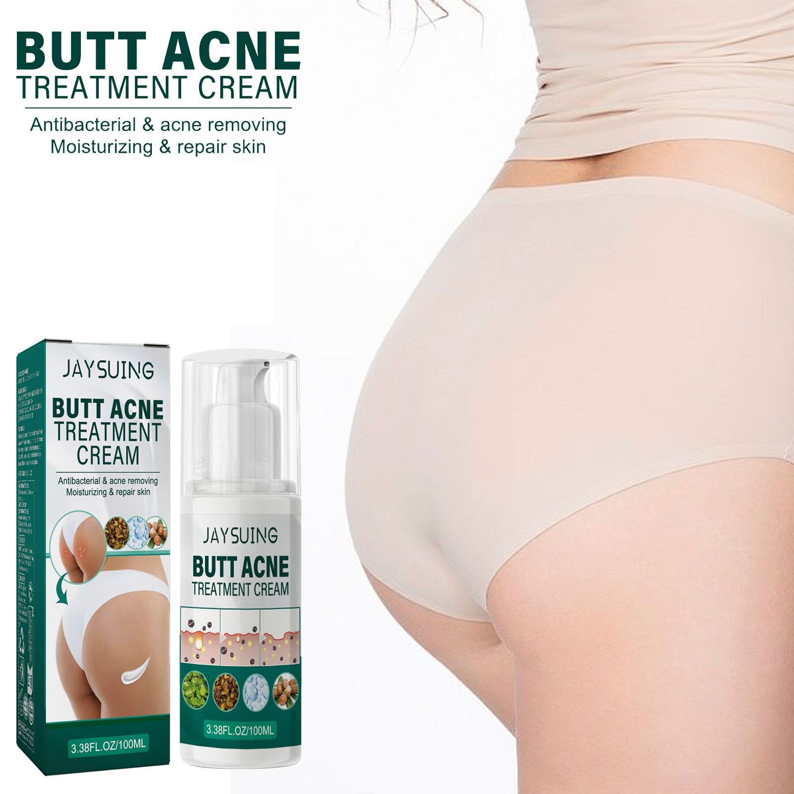Crema para tratamiento del acné y glúteos, eliminación de espinillas, limpieza de glúteos, muslo, acné, hidrata, suavizante, nutre el cuerpo, crema reparadora del acné