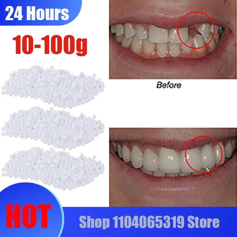 10g-100/borsa Kit di riparazione dei denti-Perline termiche per il riempimento Ripara il dente mancante e rotto o adesivo La protesi Denti finti Gutta