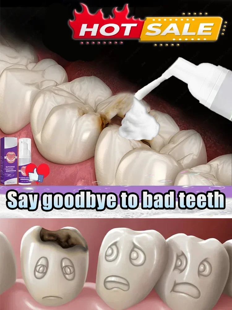 2495 Pasta de dientes para blanquear los dientes, reparación de caries, eliminación de manchas de placa, reparación de caries, tratamiento Dental