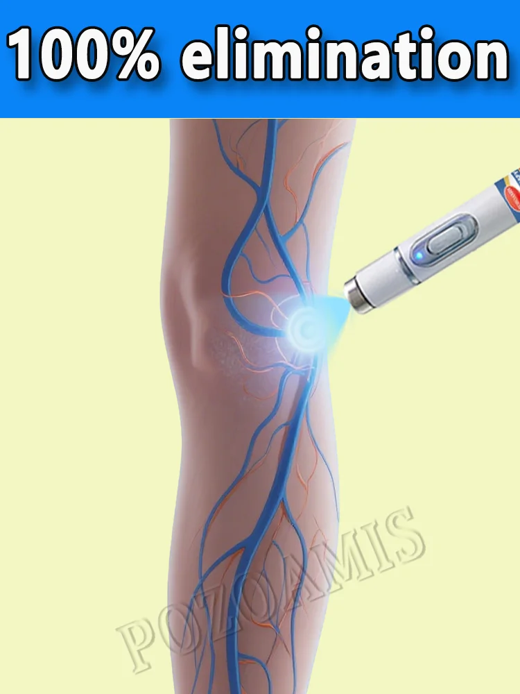 Cuidado del cuerpo, herramientas para el cuidado de las piernas, bolígrafo de luz azul, venas varicosas, gran oferta en 2025