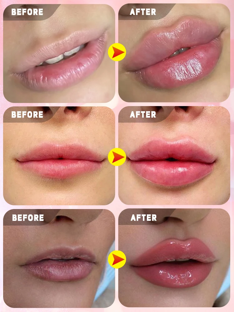 Create perfect lip shape and have a charming smile