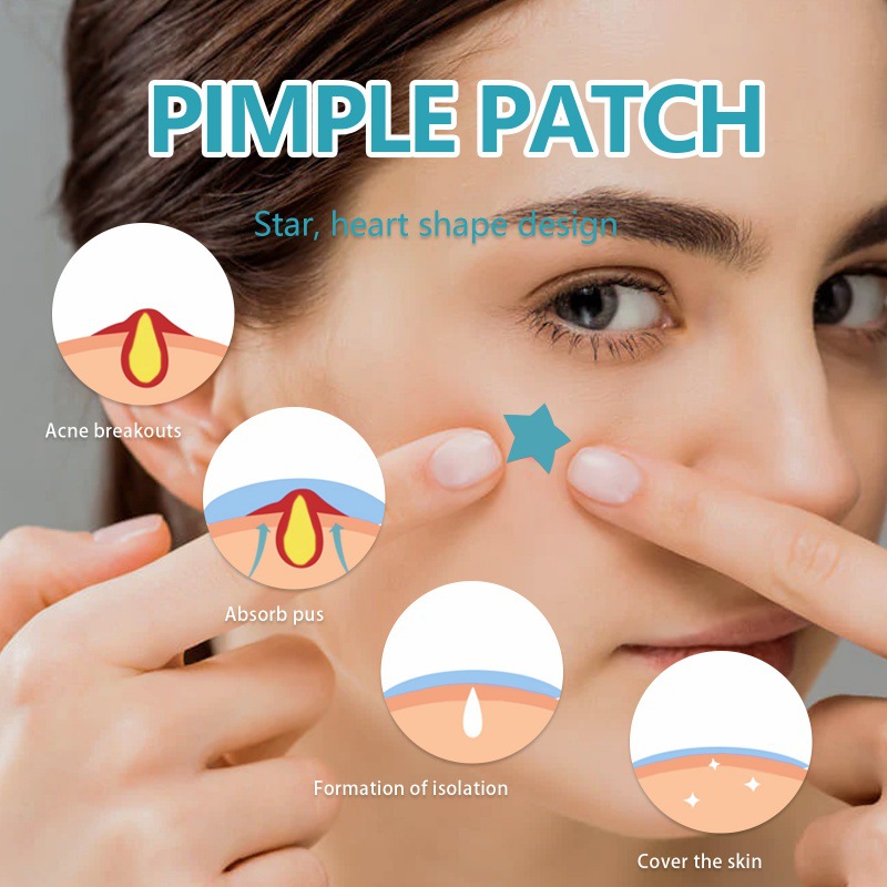 Patch hydrocolloïde pour l'acné, réparation, nettoyage de l'acné, Invisible, respirant, imperméable, correcteur de nettoyage de l'acné, estompe propre