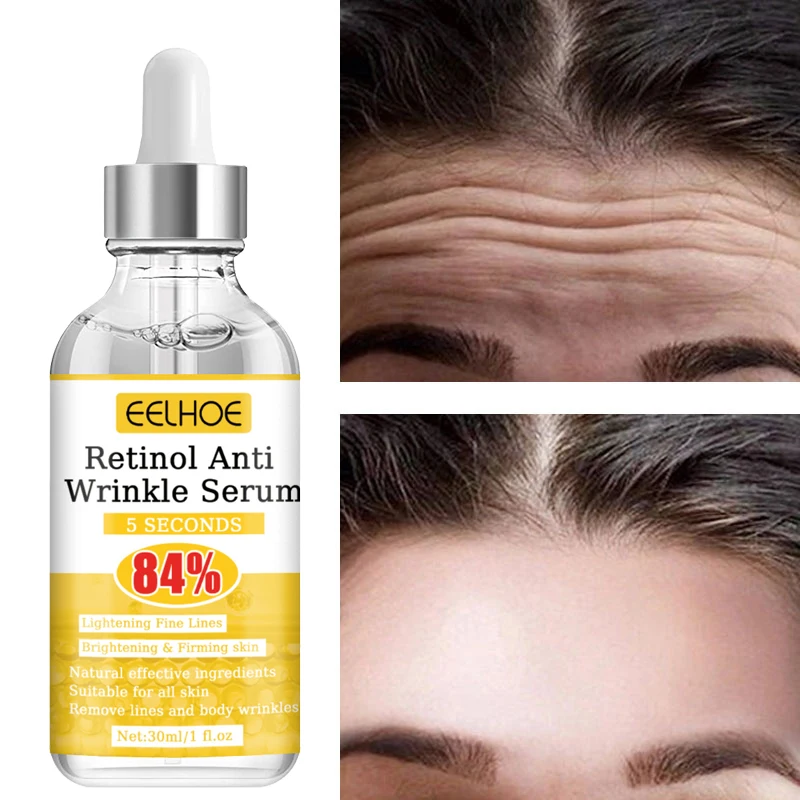 Retinol removedor instantâneo de rugas, soro facial, lifting, firmador, anti-envelhecimento, desbotamento, linhas finas, clareamento, hidratante, cuidados com a pele, cosméticos