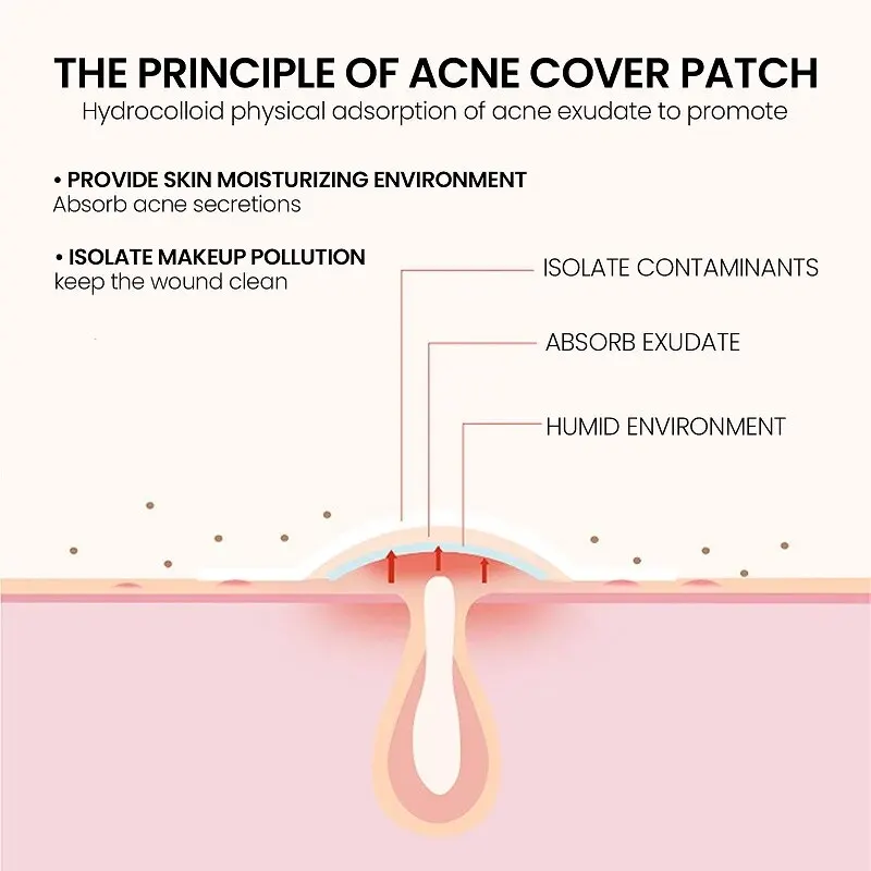 Parche de reparación de acné para el cuidado de la piel Facial, manchas, marcas de granos, manchas de acné cerradas, cubierta de granos de acné