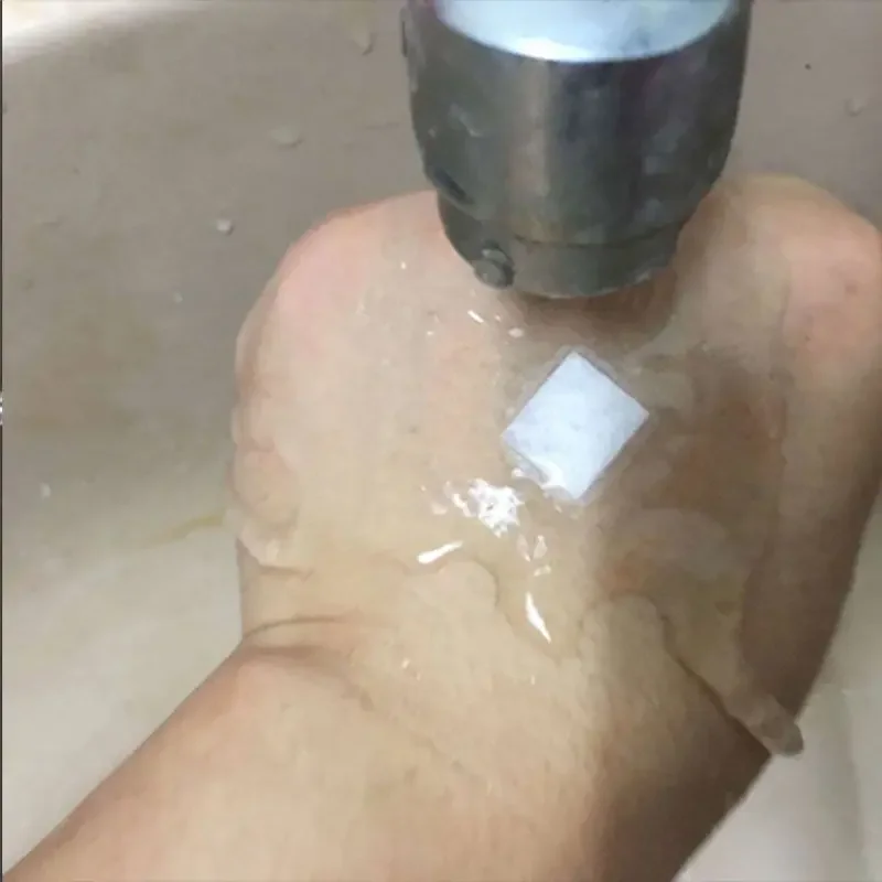 100pcs Round Band Aid Body Wound Hemostasis Sticker For Baby Skin Breathable Waterproof Transparen First Aid Bandage