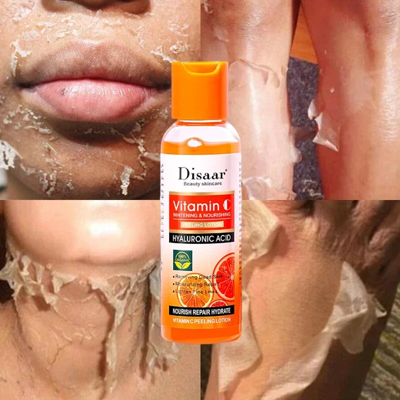 Loción exfoliante amarilla, aceite 100% blanqueador orgánico, exfoliante para la piel oscura, blanqueamiento nutritivo, ácido hialurónico, exfoliante corporal hidratante