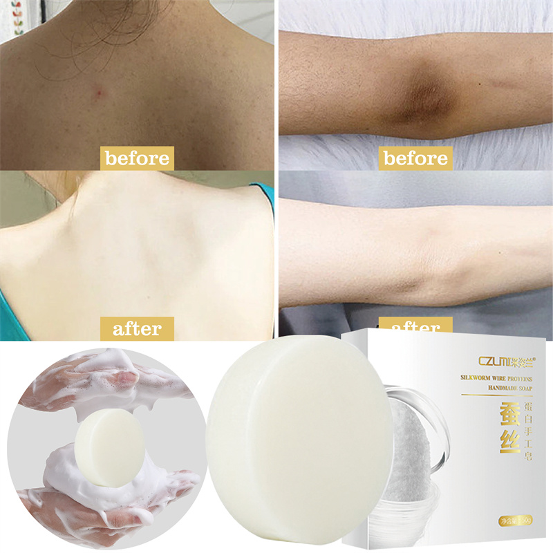 Sabonete branqueador corporal, sabonete branqueador para axilas e joelho, remoção de pele de frango, remoção de manchas escuras, hidratação da pele morta, iluminar, cuidados com o corpo