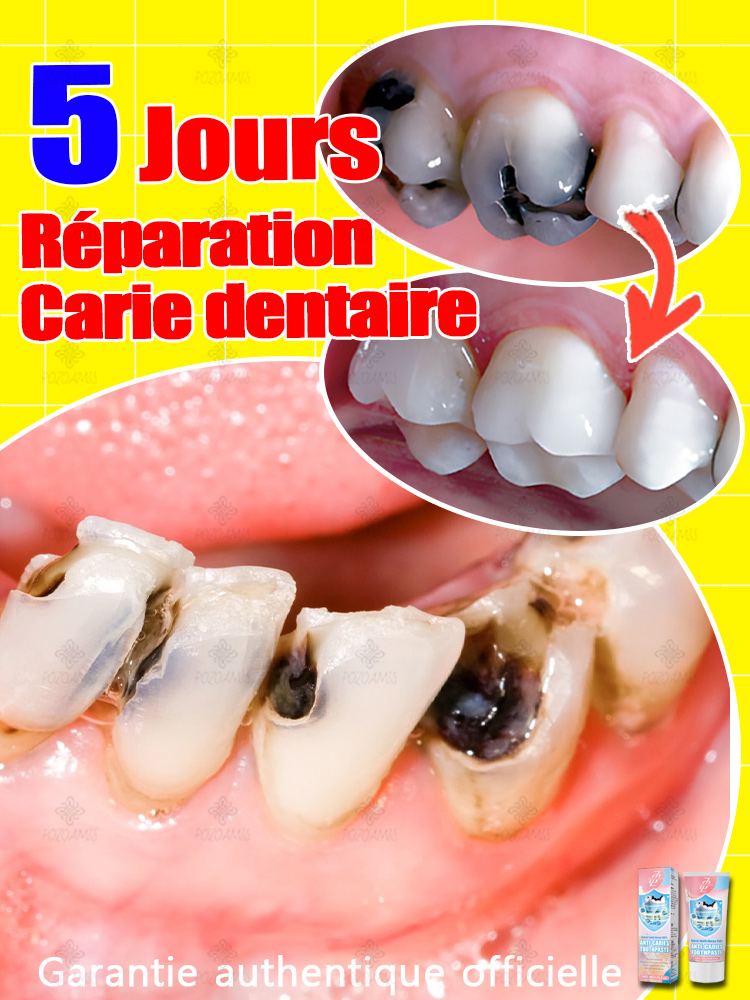 Réparer la carie dentaire, se débarrasser des maux de dents, restaurer et blanchir les dents