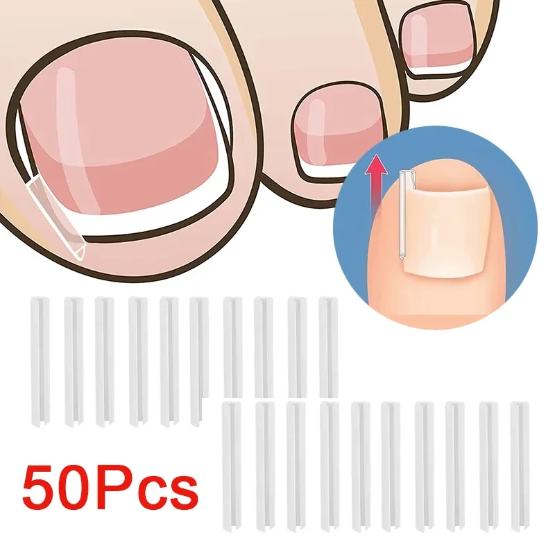 50 pçs remendo elástico adesivo ferramenta de pedicure ferramenta de correção de unha encravada tratamento de unhas do dedo do pé encravado alisamento clipe cinta