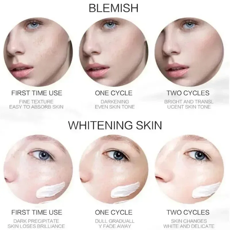 1/3/5pcs Whitening Freckle ครีม Niacinamide ลบ Dark Spot Cream Anti Freckle และ Aging ครีม Fade สีฝ้าผิว