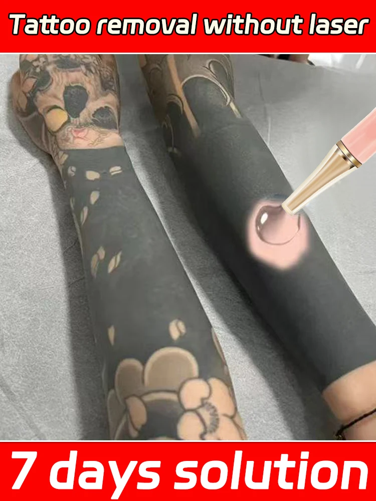 Quick Tattoo Removal cream PigmentedPermanent Makeup Tattoo Removal