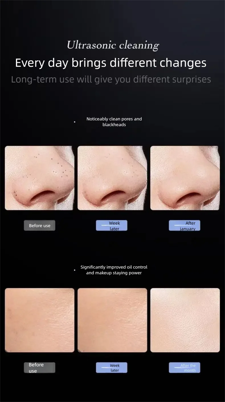 Ultrasonic Skin Scraper Vibration Beauty Device Blackhead Scraper Facial Cleansing Acne Removal Pore Cleansing Lifting Firming