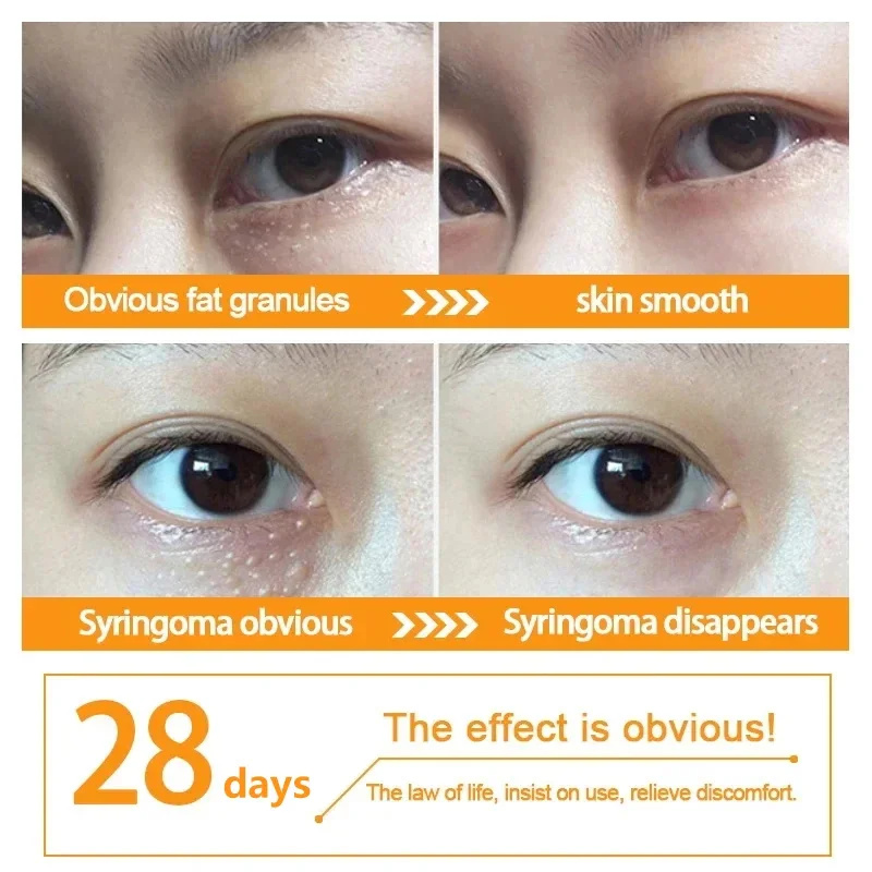 Crema para ojos eliminador de gránulos de grasa, crema firme antihinchazón, antiinflamatorio, Reduce las ojeras, desvanece las líneas finas, barrera reparadora Sk