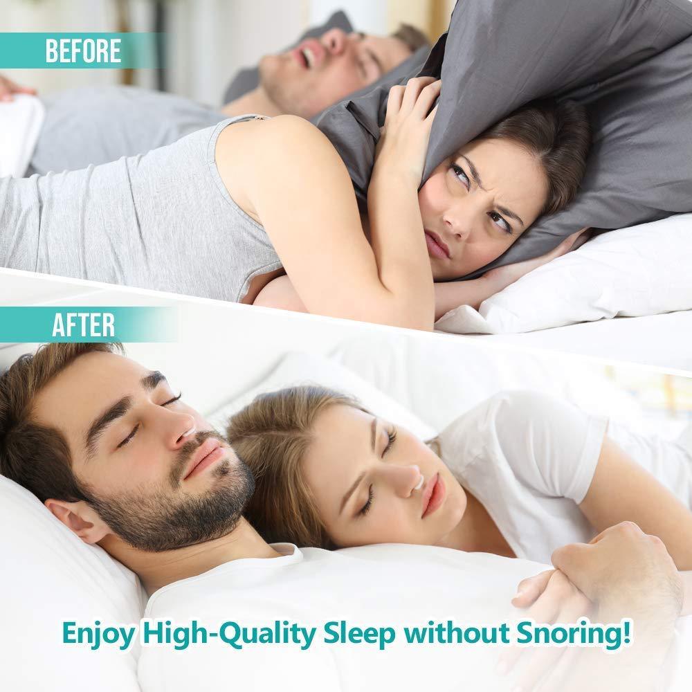 Clip magnético de silicona para dejar de roncar, bandeja para dormir, ayuda para dormir, protector de Apnea, dispositivo nocturno con funda, Anti Ronco, 1/4 Uds.