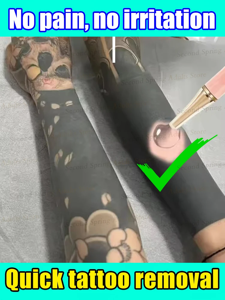 Quick Tattoo Removal cream PigmentedPermanent Makeup Tattoo Removal Hot sale in 2025