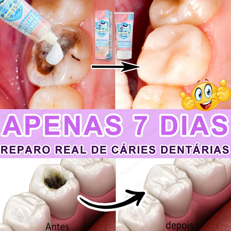99% ᴅᴀs ᴘᴇssᴏᴀs ʀᴇᴄᴏᴍᴘʀᴀ, ᴠᴇɴᴅᴀ ᴏ̨ᴜᴇɴᴛᴇ, ʀᴇᴘᴀʀᴀʀ ᴀ ᴄᴀ́ʀɪᴇ ᴅᴇɴᴛᴀ́ʀɪᴀ
