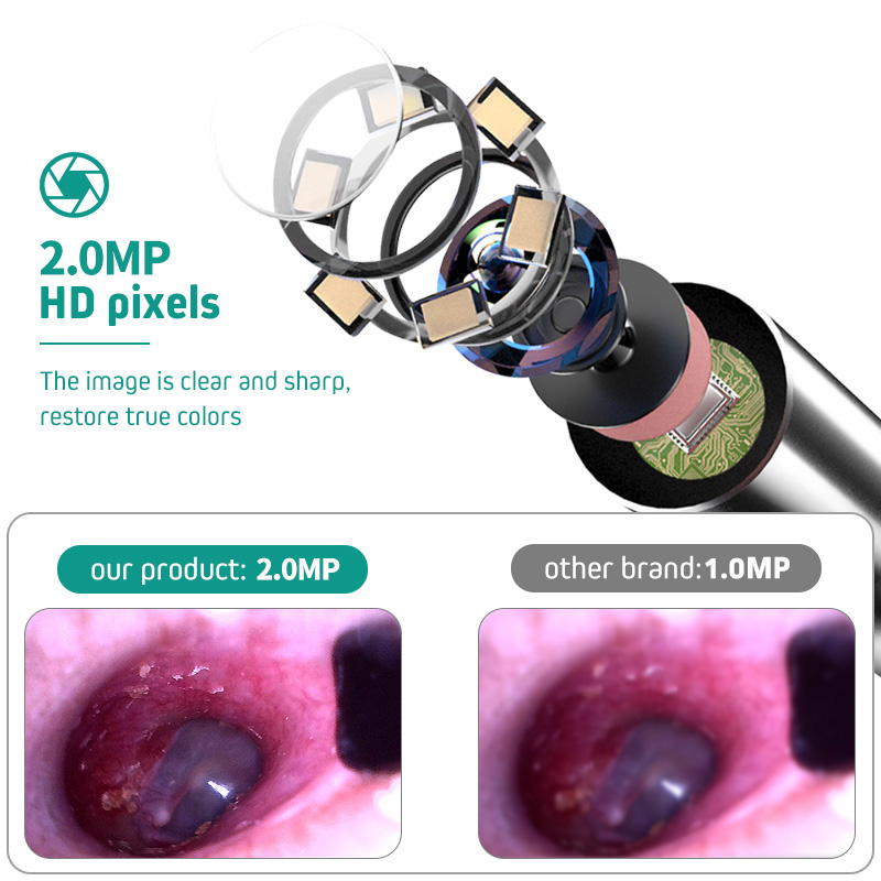 Otoscopio Digital con cámara para los oídos, otoscopio con pantalla HD IPS de 4,3 ", limpiador de oídos de 1080P con cámara para inspección de oídos en el hogar para niños y adultos