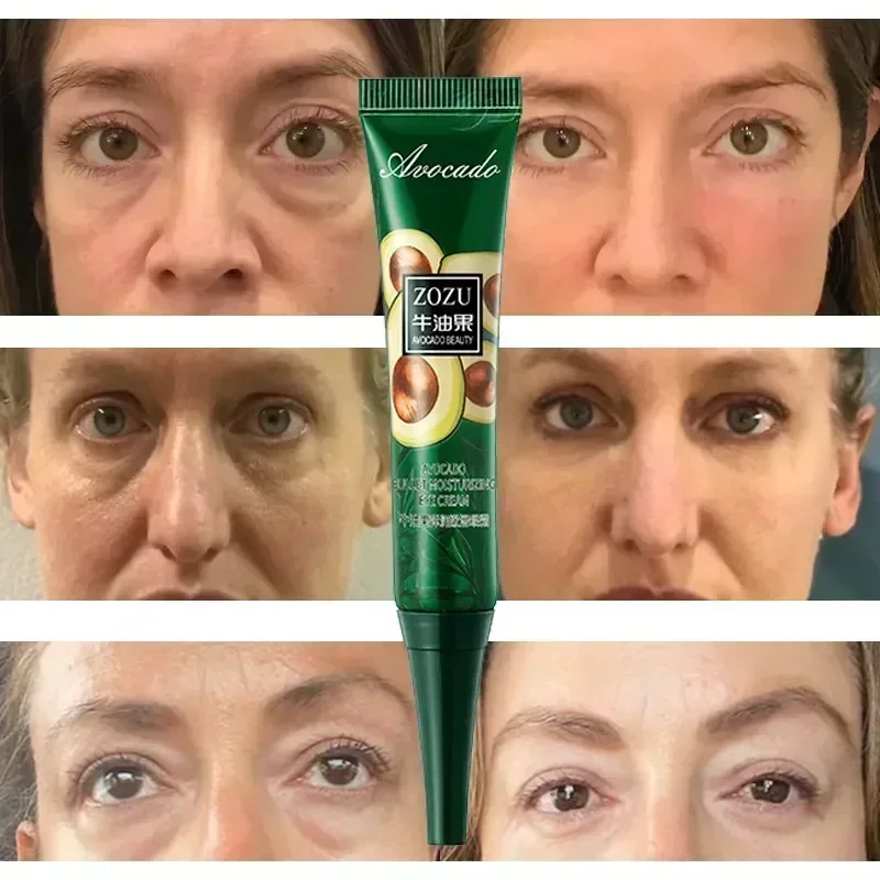 Crema para los ojos con arrugas de 7 días, antiojeras, hinchazón, líneas finas, blanqueamiento, cuidado coreano de la piel, novedad de 2023