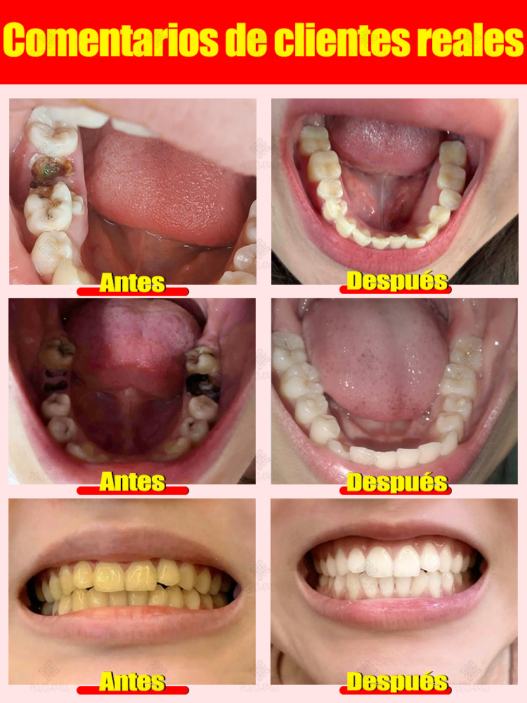 Reparar las caries, eliminar el dolor de muelas, restaurar y blanquear los dientes.