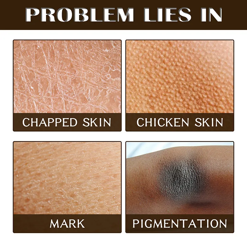 Kawa Peeling do ciała Krem Złuszczający Wybielacz Łokieć Pod pachami Kolano Melanina Pigmentacja Wybielanie Usuń martwy naskórek Peeling pod prysznic