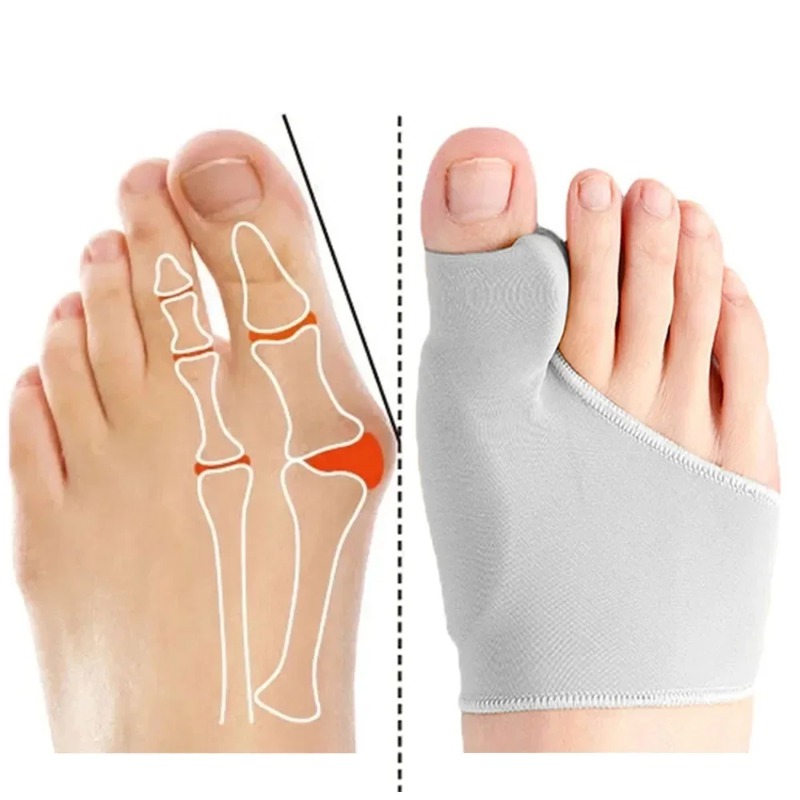 Hallux Valgus Bunion Corrector Orthotics Toe Separator - Feet Bone Thumb Adjuster Pedicure Sock Straightener for Foot Health