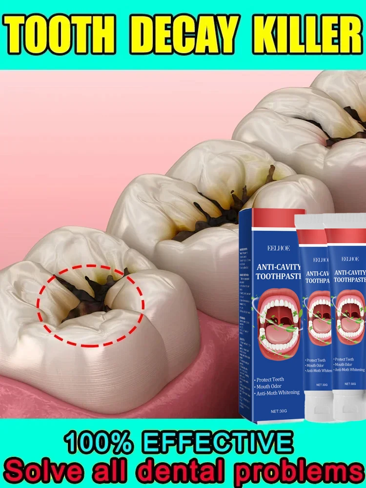 Cavity Anti-cavities Toothpaste Teeth Whitening Bad Breath Repair Cavities Remove Plaque Toothache Relives Periodontitis