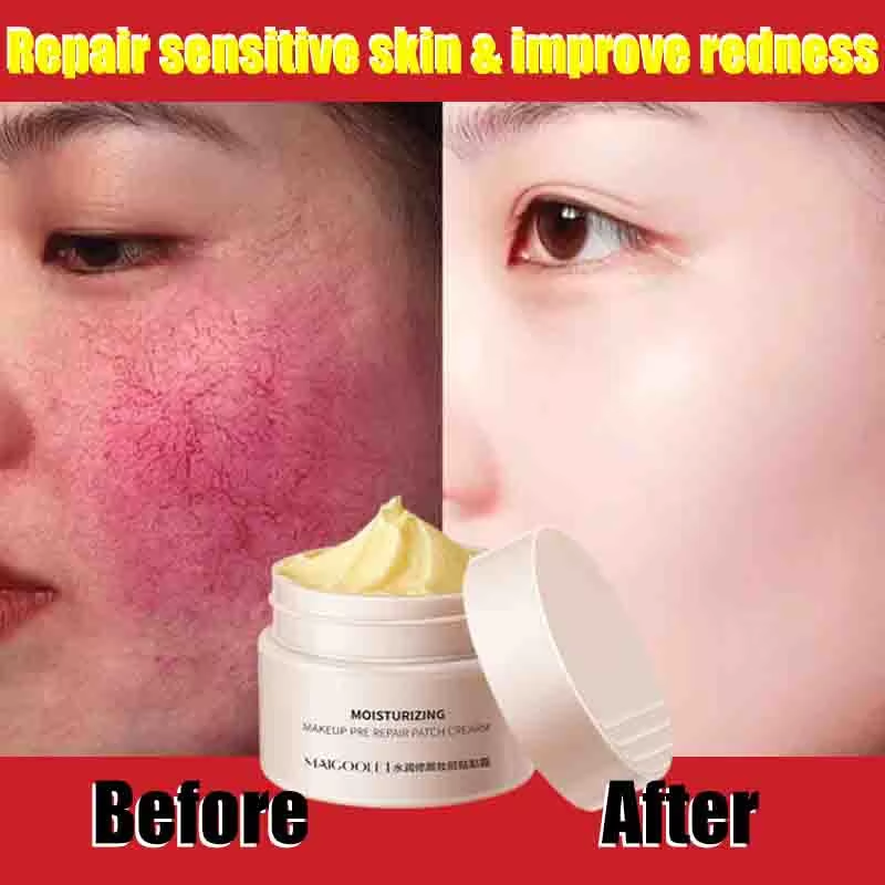 Восстанавливающий крем для лица, улучшающий чувствительную кожу, сухость, увлажняющий крем, увлажняющий успокаивающий лосьон для удаления розацея, корейская косметика