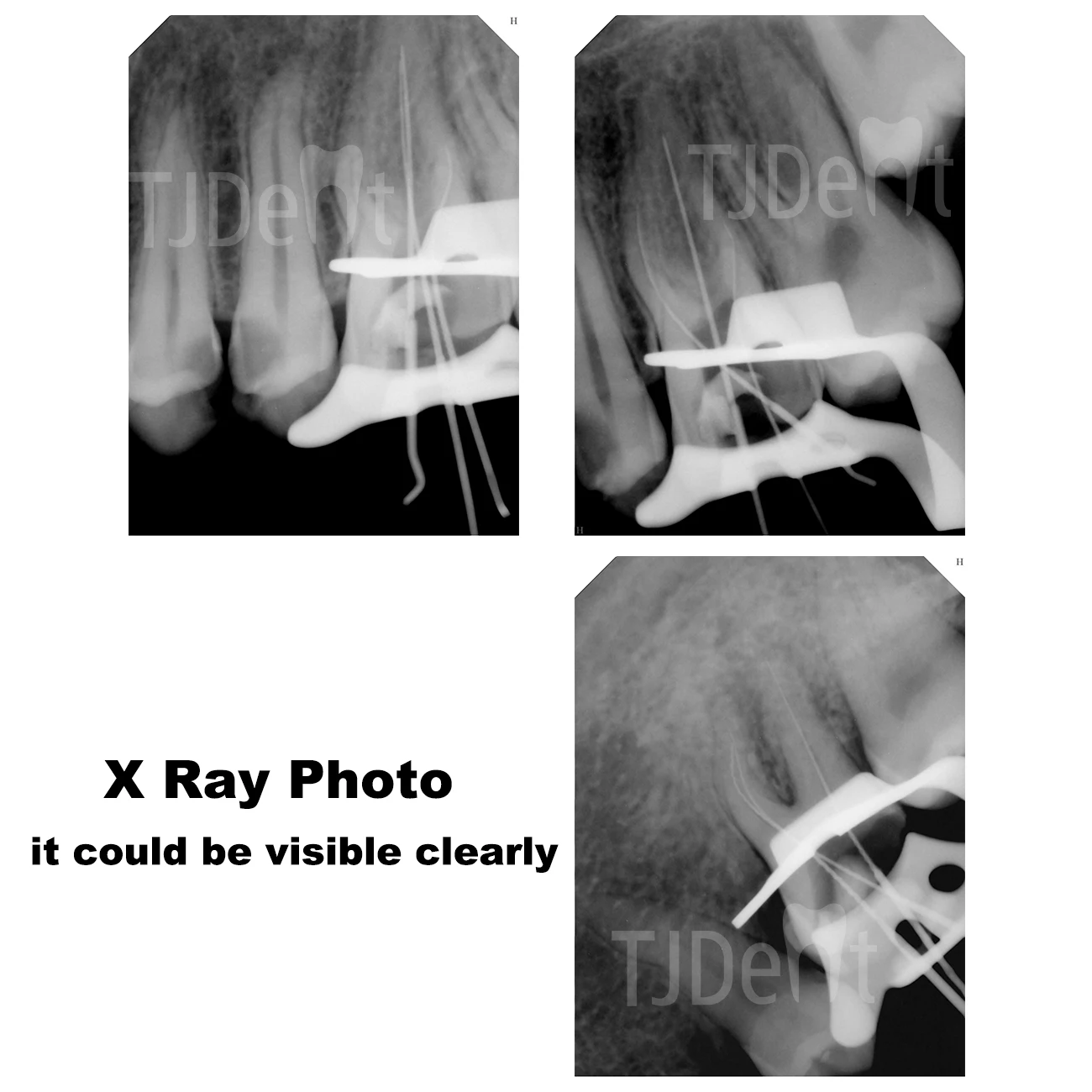 TJDent Dental Gutta taper 02 04 06 15 # -40 #   F1 F2 F3 F4 F5 Ze skalą Endodoncja Papier chłonny Materiały stomatologiczne Materiały eksploatacyjne