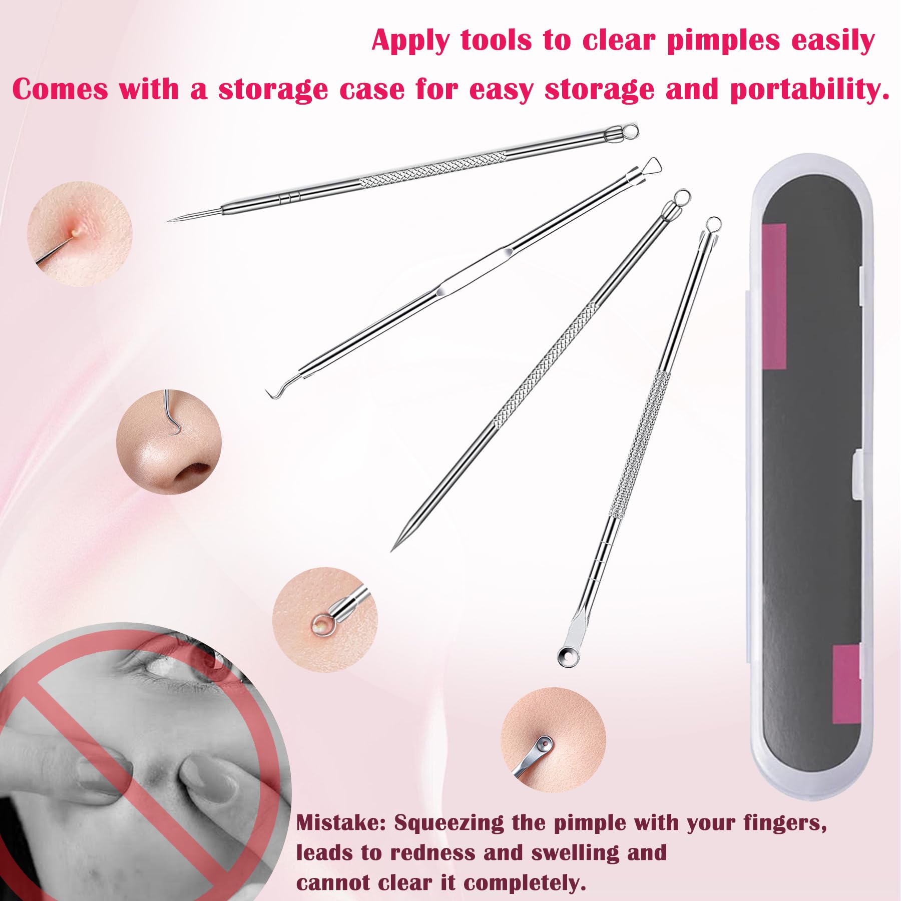 Silver 4-Pack Blackhead Remover Comedones Extractor Removal Kit - For Blemishes, Whiteheads Removal Facial Skin Care (With Box)