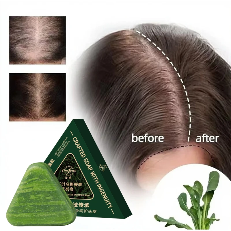 Шампунь против выпадения волос! С Platycladura Usnea Herb Controls Oil Dandruff Reduce Breakage Твердый шампунь ручной работы для объема