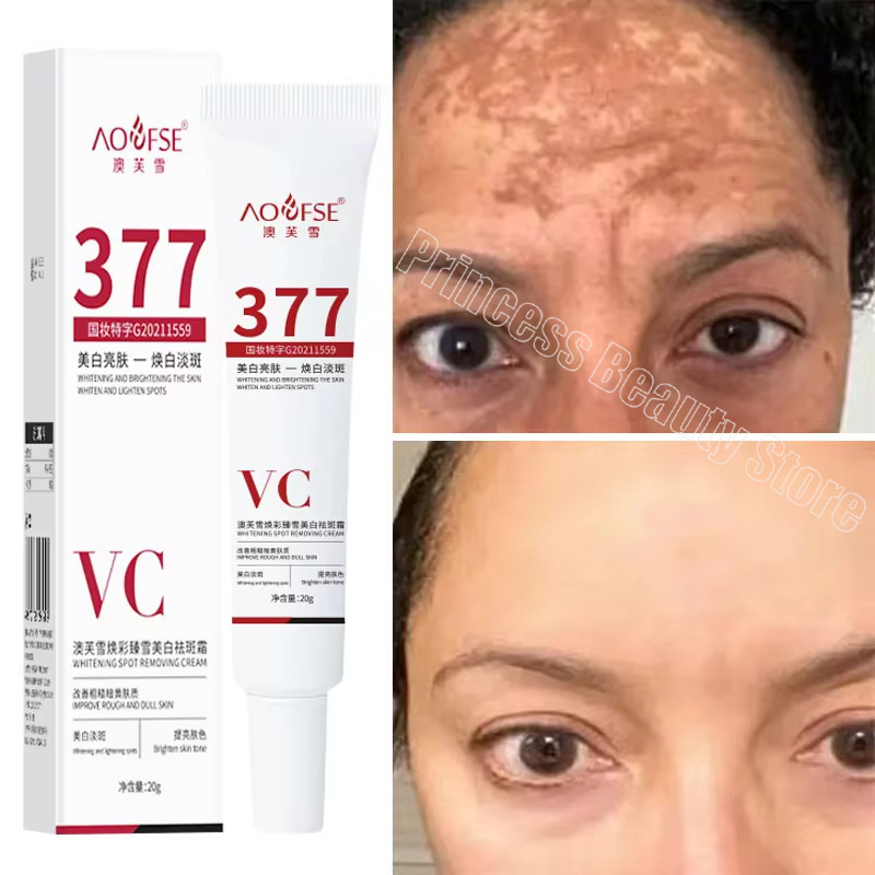 Crema iluminadora de melasma niacinamida, crema iluminadora para reducir la melanina, aclara la piel oscura, suero reparador de cloasma, productos para el cuidado facial